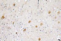 FGF-1 Polyclonal Antibody