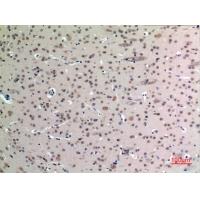 FGF-12 Polyclonal Antibody