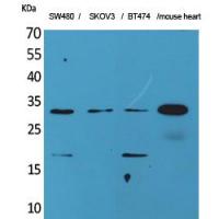 FGF-18 Polyclonal Antibody