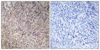 FGF-22 Polyclonal Antibody