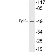 Fgl2 Polyclonal Antibody