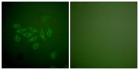 Fhit Polyclonal Antibody