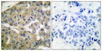 Fhit Polyclonal Antibody