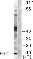 Fhit Polyclonal Antibody