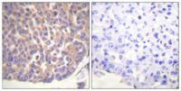 Filamin 1 Polyclonal Antibody
