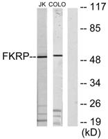 FKRP Polyclonal Antibody