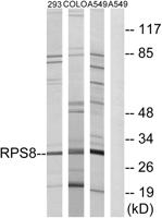 Ribosomal Protein S8 Polyclonal Antibody