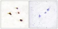 InsP6 Kinase 3 Polyclonal Antibody