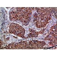 Integrin α1 Polyclonal Antibody