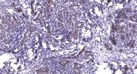 Integrin β7 Polyclonal Antibody