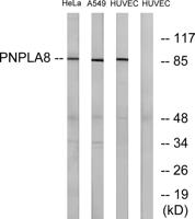 iPLA2γ Polyclonal Antibody
