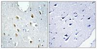 IRF-4 Polyclonal Antibody