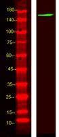 ABCBB Polyclonal Antibody