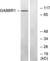 GABAB R1 Polyclonal Antibody