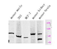 KCNQ5 Polyclonal Antibody