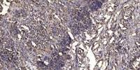 KCTD7 Polyclonal Antibody