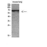 Keratin-pan Polyclonal Antibody