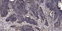 KIF2C Polyclonal Antibody