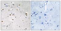KOX4 Polyclonal Antibody