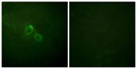 Kv1.3 Polyclonal Antibody