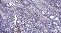 Kv2.1/KCNB1 Polyclonal Antibody