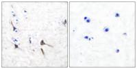 KV3.2 Polyclonal Antibody