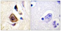 Kv3.4 Polyclonal Antibody