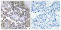 Laminin β-2 Polyclonal Antibody