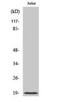 Cofilin Polyclonal Antibody