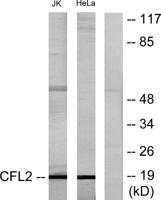 Cofilin Polyclonal Antibody