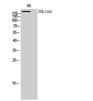 COL11A1 Polyclonal Antibody