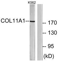 COL11A1 Polyclonal Antibody