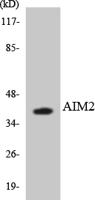 COL18A1 Polyclonal Antibody