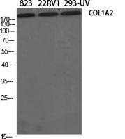 COL1A2 Polyclonal Antibody