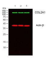 COL2A1 Polyclonal Antibody