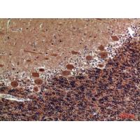 COL5A2 Polyclonal Antibody