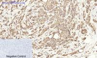 COX-2 Polyclonal Antibody