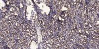 RIN3 Polyclonal Antibody
