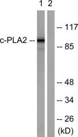 cPLA2 Polyclonal Antibody