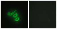 Creatine Kinase M Polyclonal Antibody