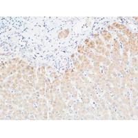 CRP Polyclonal Antibody