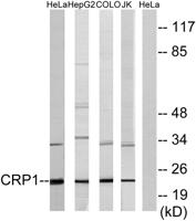 CRP1 Polyclonal Antibody