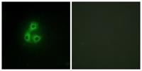 Csk Polyclonal Antibody