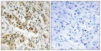 CtBP1 Polyclonal Antibody