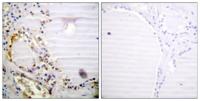 CtIP Polyclonal Antibody