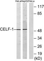 CUG-BP1 Polyclonal Antibody