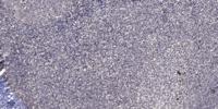 CUG-BP1 Polyclonal Antibody