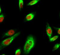 Cyclin D1 Polyclonal Antibody