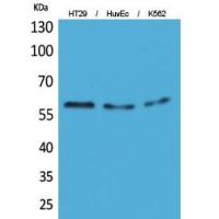 CYP11B1/2 Polyclonal Antibody