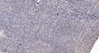 GBDR1 Polyclonal Antibody